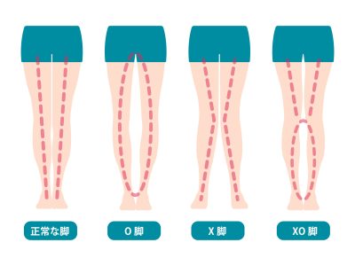 Difference types of  legs angles and knees vector illustration (Japanese)